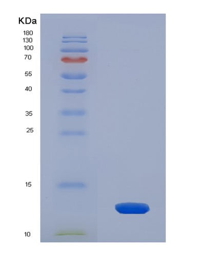 SDS-PAGE analysis of Human SLC2A1 (Solute Carrier Family 2, Facilitated Glucose Transporter Member 1) - Recombinant Protein, CAT# BLT-08009P, showing >90% purity under 15% SDS-PAGE (Reduced)Human SLC2A1 (Solute Carrier Family 2, Facilitated Glucose Transporter Member 1) - Recombinant Protein