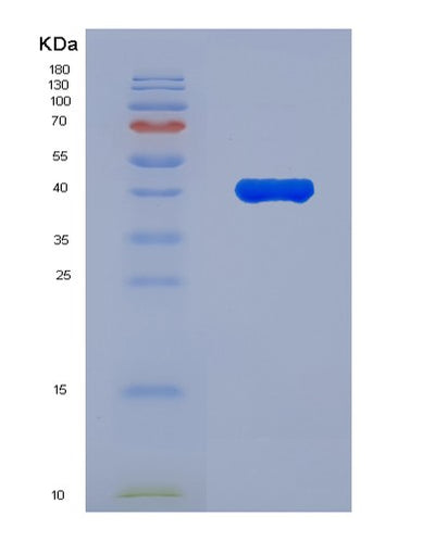 SDS-PAGE analysis of Human DHCR7 (7-Dehydrocholesterol Reductase) - Recombinant Protein, CAT# BLT-08010P, showing >90% purity under 15% SDS-PAGE (Reduced)Human DHCR7 (7-Dehydrocholesterol Reductase) - Recombinant Protein