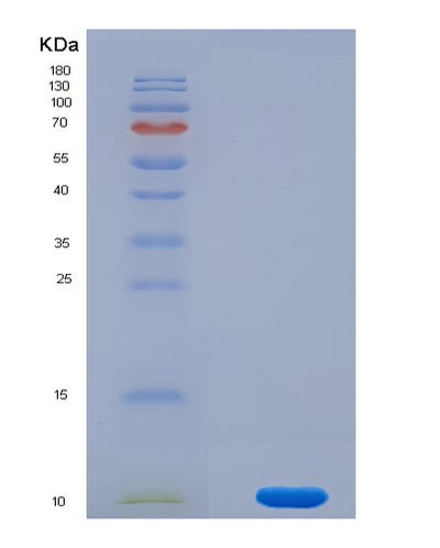 SDS-PAGE analysis of Mouse Cxcl5 (C-X-C Motif Chemokine 5) - Recombinant Protein, CAT# BLT-08016P, showing >90% purity under 15% SDS-PAGE (Reduced)Mouse Cxcl5 (C-X-C Motif Chemokine 5) - Recombinant Protein