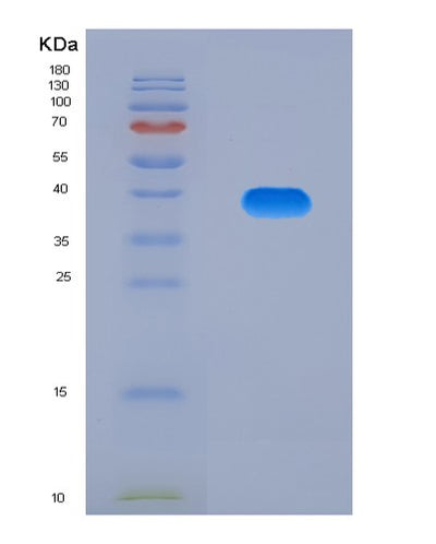 SDS-PAGE analysis of Mouse Ccl5 (C-C Motif Chemokine 5) - Recombinant Protein, CAT# BLT-08017P, showing >90% purity under 15% SDS-PAGE (Reduced)Mouse Ccl5 (C-C Motif Chemokine 5) - Recombinant Protein