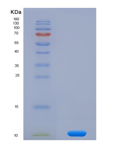 SDS-PAGE analysis of Mouse Chemokine (C-X-C motif) ligand 7 ( CXCL7) - Recombinant Protein, CAT# BLT-08018P, showing >90% purity under 15% SDS-PAGE (Reduced)Mouse Chemokine (C-X-C motif) ligand 7 ( CXCL7) - Recombinant Protein