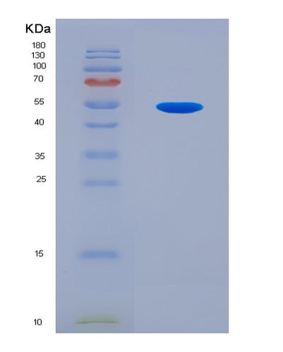 SDS-PAGE analysis of Human TGIF1 (Homeobox Protein Tgif1) - Recombinant Protein, CAT# BLT-08020P, showing >90% purity under 15% SDS-PAGE (Reduced)Human TGIF1 (Homeobox Protein Tgif1) - Recombinant Protein