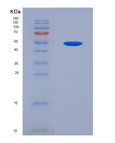 SDS-PAGE analysis of Human TGIF1 (Homeobox Protein Tgif1) - Recombinant Protein, CATHuman TGIF1 (Homeobox Protein Tgif1) - Recombinant Protein