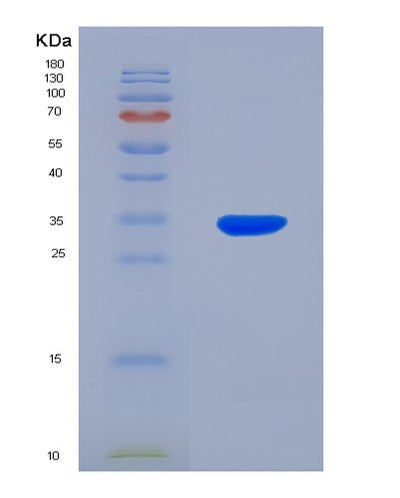 SDS-PAGE analysis of Human PLAT (Tissue-Type Plasminogen Activator) - Recombinant Protein, CAT# BLT-08021P, showing >90% purity under 15% SDS-PAGE (Reduced)Human PLAT (Tissue-Type Plasminogen Activator) - Recombinant Protein