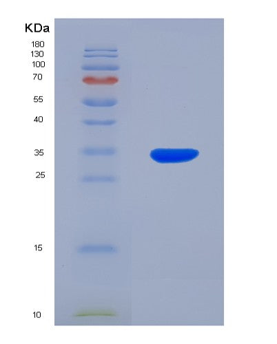 SDS-PAGE analysis of Human PLAT (Tissue-Type Plasminogen Activator) - Recombinant Protein, CATHuman PLAT (Tissue-Type Plasminogen Activator) - Recombinant Protein