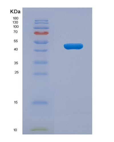 SDS-PAGE analysis of Human SERPINE1 (Plasminogen Activator Inhibitor 1) - Recombinant Protein, CAT# BLT-08022P, showing >90% purity under 15% SDS-PAGE (Reduced)Human SERPINE1 (Plasminogen Activator Inhibitor 1) - Recombinant Protein