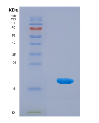 SDS-PAGE analysis of Human CD274 (Programmed Cell Death 1 Ligand 1) - Recombinant Protein, CATHuman CD274 (Programmed Cell Death 1 Ligand 1) - Recombinant Protein