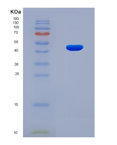 SDS-PAGE analysis of Human FCAR (Immunoglobulin Alpha Fc Receptor) - Recombinant Protein, CATHuman FCAR (Immunoglobulin Alpha Fc Receptor) - Recombinant Protein