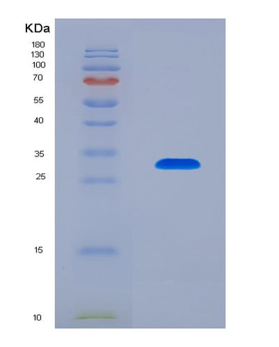SDS-PAGE analysis of Human ATXN1 (Ataxin-1) - Recombinant Protein, CAT# BLT-08025P, showing >90% purity under 15% SDS-PAGE (Reduced)Human ATXN1 (Ataxin-1) - Recombinant Protein