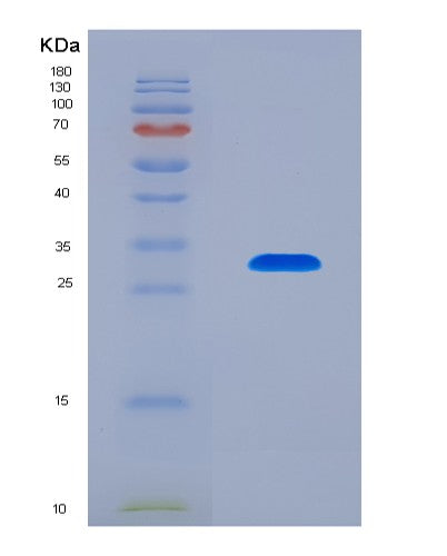 SDS-PAGE analysis of Human ATXN1 (Ataxin-1) - Recombinant Protein, CATHuman ATXN1 (Ataxin-1) - Recombinant Protein