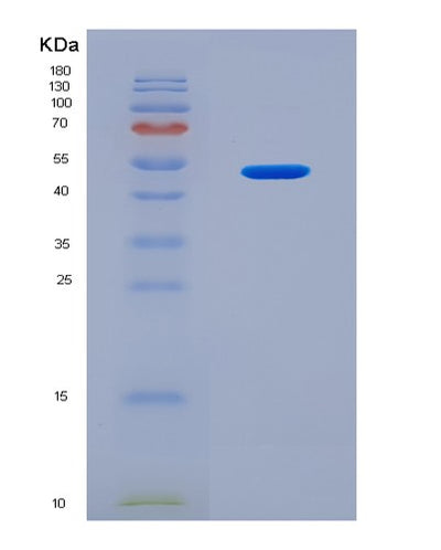 SDS-PAGE analysis of Mouse Lgmn (Legumain) - Recombinant Protein, CAT# BLT-08026P, showing >90% purity under 15% SDS-PAGE (Reduced)Mouse Lgmn (Legumain) - Recombinant Protein