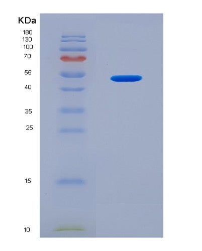 SDS-PAGE analysis of Mouse Lgmn (Legumain) - Recombinant Protein, CATMouse Lgmn (Legumain) - Recombinant Protein