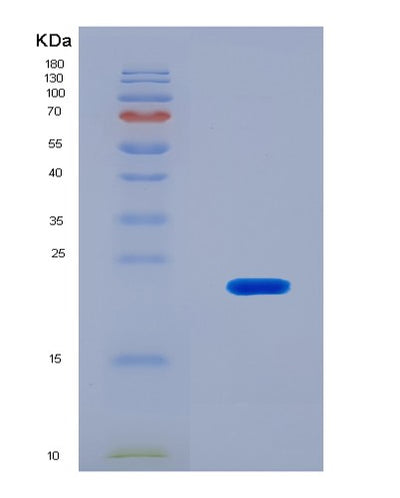 SDS-PAGE analysis of Mouse Cd40 (Tumor Necrosis Factor Receptor Superfamily Member 5) - Recombinant Protein, CAT# BLT-08027P, showing >90% purity under 15% SDS-PAGE (Reduced)Mouse Cd40 (Tumor Necrosis Factor Receptor Superfamily Member 5) - Recombinant Protein