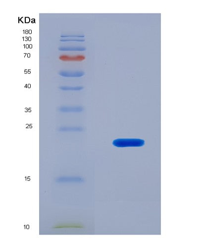 SDS-PAGE analysis of Mouse Cd40 (Tumor Necrosis Factor Receptor Superfamily Member 5) - Recombinant Protein, CATMouse Cd40 (Tumor Necrosis Factor Receptor Superfamily Member 5) - Recombinant Protein
