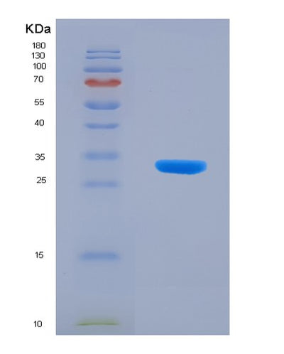 SDS-PAGE analysis of Human SARM1 (Nad(+) Hydrolase Sarm1) - Recombinant Protein, CAT# BLT-08031P, showing >90% purity under 15% SDS-PAGE (Reduced)Human SARM1 (Nad(+) Hydrolase Sarm1) - Recombinant Protein