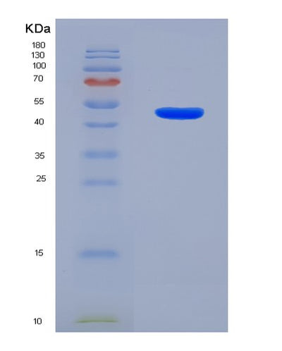 SDS-PAGE analysis of Human ANGPTL4 (Angiopoietin-Related Protein 4) - Recombinant Protein, CAT# BLT-08034P, showing >90% purity under 15% SDS-PAGE (Reduced)Human ANGPTL4 (Angiopoietin-Related Protein 4) - Recombinant Protein
