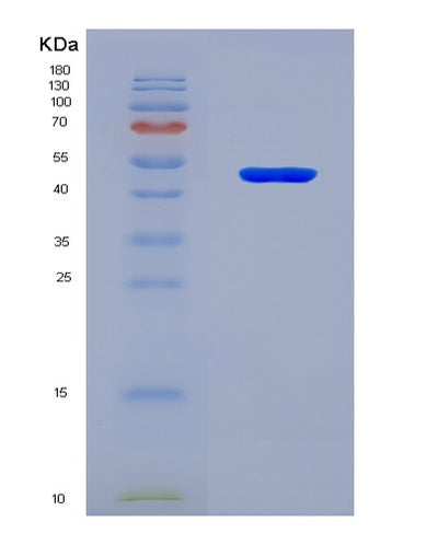 SDS-PAGE analysis of Human UBR5 (E3 Ubiquitin-Protein Ligase Ubr5) - Recombinant Protein, CAT# BLT-08035P, showing >90% purity under 15% SDS-PAGE (Reduced)Human UBR5 (E3 Ubiquitin-Protein Ligase Ubr5) - Recombinant Protein