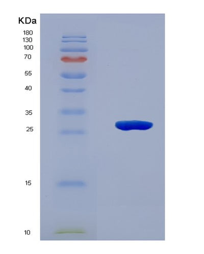 SDS-PAGE analysis of Human JAG1 (Protein Jagged-1) - Recombinant Protein, CAT# BLT-08037P, showing >90% purity under 15% SDS-PAGE (Reduced)Human JAG1 (Protein Jagged-1) - Recombinant Protein