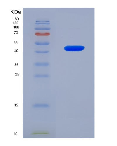 SDS-PAGE analysis of Human LRP1 (Prolow-Density Lipoprotein Receptor-Related Protein 1) - Recombinant Protein, CAT# BLT-08040P, showing >90% purity under 15% SDS-PAGE (Reduced)Human LRP1 (Prolow-Density Lipoprotein Receptor-Related Protein 1) - Recombinant Protein