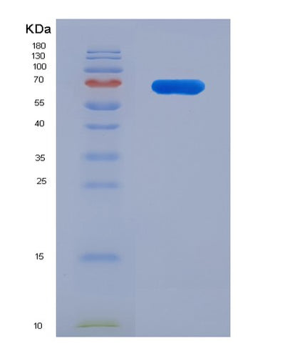 SDS-PAGE analysis of Human ALDH9A1 (4-Trimethylaminobutyraldehyde Dehydrogenase) - Recombinant Protein, CAT# BLT-08041P, showing >90% purity under 15% SDS-PAGE (Reduced)Human ALDH9A1 (4-Trimethylaminobutyraldehyde Dehydrogenase) - Recombinant Protein