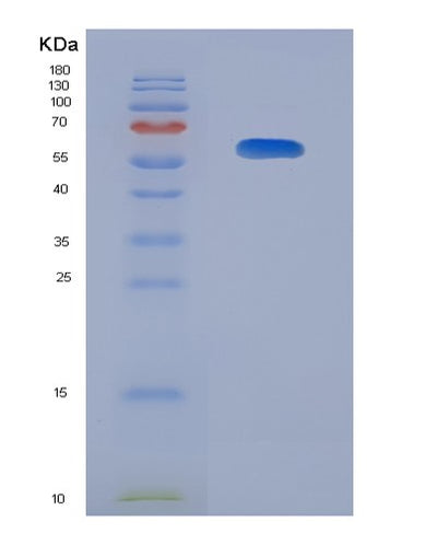 SDS-PAGE analysis of Human HLA-A (Hla Class I Histocompatibility Antigen, A Alpha Chain) - Recombinant Protein, CAT# BLT-08042P, showing >90% purity under 15% SDS-PAGE (Reduced)Human HLA-A (Hla Class I Histocompatibility Antigen, A Alpha Chain) - Recombinant Protein