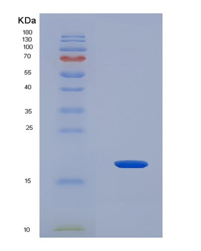 SDS-PAGE analysis of Human RXFP1 (Relaxin Receptor 1) - Recombinant Protein, CAT# BLT-08043P, showing >90% purity under 15% SDS-PAGE (Reduced)Human RXFP1 (Relaxin Receptor 1) - Recombinant Protein