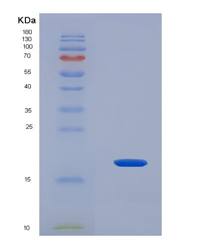 SDS-PAGE analysis of Human RXFP1 (Relaxin Receptor 1) - Recombinant Protein, CATHuman RXFP1 (Relaxin Receptor 1) - Recombinant Protein