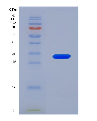 SDS-PAGE analysis of Human JAK1 (Tyrosine-Protein Kinase Jak1) - Recombinant Protein, CATHuman JAK1 (Tyrosine-Protein Kinase Jak1) - Recombinant Protein
