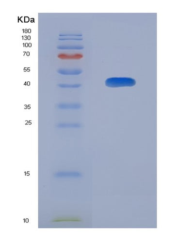 SDS-PAGE analysis of Human CAMK1D (Calcium/Calmodulin-Dependent Protein Kinase Type 1D) - Recombinant Protein, CAT# BLT-08046P, showing >90% purity under 15% SDS-PAGE (Reduced)Human CAMK1D (Calcium/Calmodulin-Dependent Protein Kinase Type 1D) - Recombinant Protein