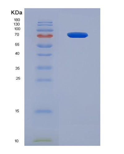 SDS-PAGE analysis of Human ESR1 (Estrogen Receptor) - Recombinant Protein, CAT# BLT-08047P, showing >90% purity under 15% SDS-PAGE (Reduced)Human ESR1 (Estrogen Receptor) - Recombinant Protein