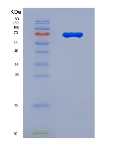 SDS-PAGE analysis of Human ESR2 (Estrogen Receptor Beta) - Recombinant Protein, CAT# BLT-08048P, showing >90% purity under 15% SDS-PAGE (Reduced)Human ESR2 (Estrogen Receptor Beta) - Recombinant Protein