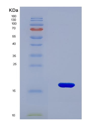 SDS-PAGE analysis of Human BRD4 (Bromodomain-Containing Protein 4) - Recombinant Protein, CAT# BLT-08049P, showing >90% purity under 15% SDS-PAGE (Reduced)Human BRD4 (Bromodomain-Containing Protein 4) - Recombinant Protein