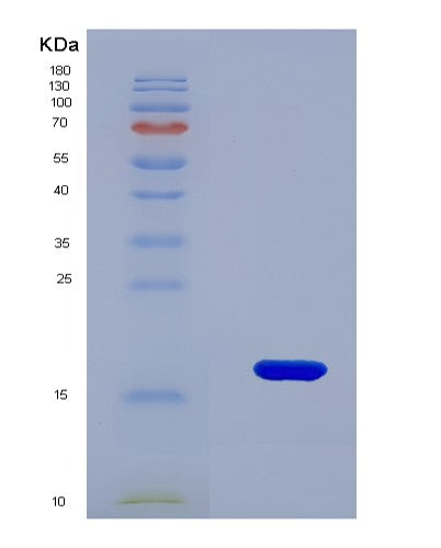 SDS-PAGE analysis of Human BRD4 (Bromodomain-Containing Protein 4) - Recombinant Protein, CATHuman BRD4 (Bromodomain-Containing Protein 4) - Recombinant Protein
