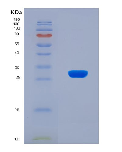 SDS-PAGE analysis of Human AP2B1 (Ap-2 Complex Subunit Beta) - Recombinant Protein, CAT# BLT-08051P, showing >90% purity under 15% SDS-PAGE (Reduced)Human AP2B1 (Ap-2 Complex Subunit Beta) - Recombinant Protein