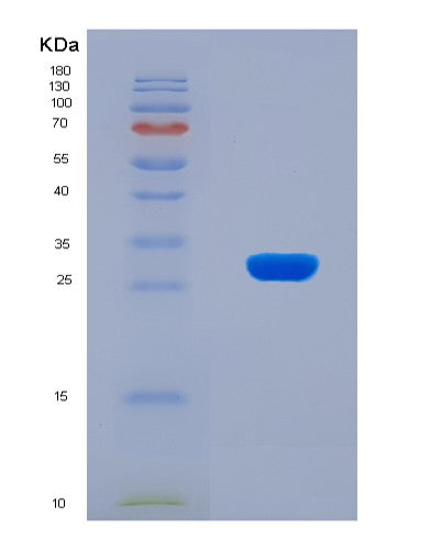 SDS-PAGE analysis of Human AP2B1 (Ap-2 Complex Subunit Beta) - Recombinant Protein, CATHuman AP2B1 (Ap-2 Complex Subunit Beta) - Recombinant Protein
