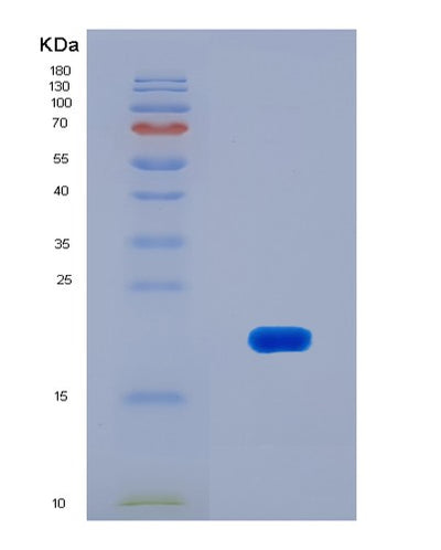 SDS-PAGE analysis of Human MAP3K7CL (Map3K7 C-Terminal-Like Protein) - Recombinant Protein, CAT# BLT-08052P, showing >90% purity under 15% SDS-PAGE (Reduced)Human MAP3K7CL (Map3K7 C-Terminal-Like Protein) - Recombinant Protein