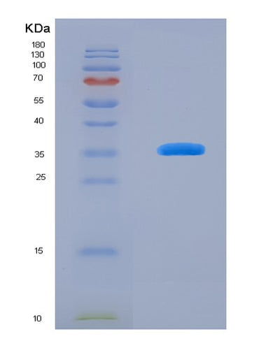 SDS-PAGE analysis of Human MAP3K7CL (Map3K7 C-Terminal-Like Protein) - Recombinant Protein, CAT# BLT-08055P, showing >90% purity under 15% SDS-PAGE (Reduced)Human MAP3K7CL (Map3K7 C-Terminal-Like Protein) - Recombinant Protein
