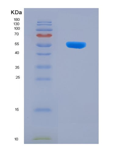 SDS-PAGE analysis of Human CTRC (Chymotrypsin-C) - Recombinant Protein, CAT# BLT-08057P, showing >90% purity under 15% SDS-PAGE (Reduced)Human CTRC (Chymotrypsin-C) - Recombinant Protein