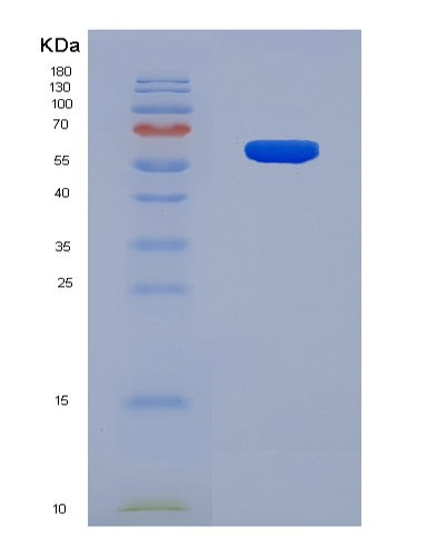 SDS-PAGE analysis of Human ATM (Serine-Protein Kinase Atm) - Recombinant Protein, CATHuman ATM (Serine-Protein Kinase Atm) - Recombinant Protein