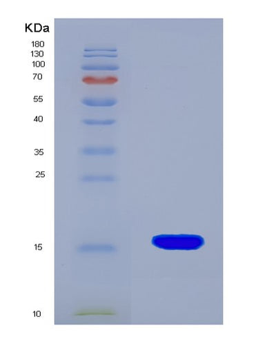 SDS-PAGE analysis of Human NPY1R (Neuropeptide Y Receptor Type 1) - Recombinant Protein, CAT# BLT-08062P, showing >90% purity under 15% SDS-PAGE (Reduced)Human NPY1R (Neuropeptide Y Receptor Type 1) - Recombinant Protein