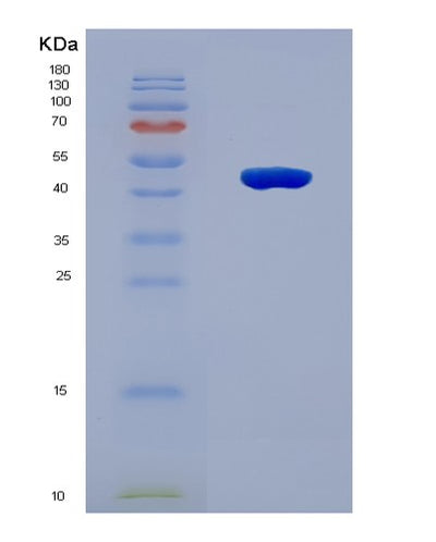 SDS-PAGE analysis of Human BBS5 (Bbsome Complex Member Bbs5) - Recombinant Protein, CAT# BLT-08063P, showing >90% purity under 15% SDS-PAGE (Reduced)Human BBS5 (Bbsome Complex Member Bbs5) - Recombinant Protein