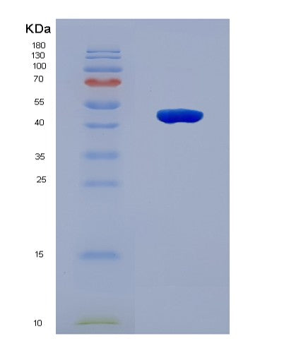 SDS-PAGE analysis of Human BBS5 (Bbsome Complex Member Bbs5) - Recombinant Protein, CATHuman BBS5 (Bbsome Complex Member Bbs5) - Recombinant Protein