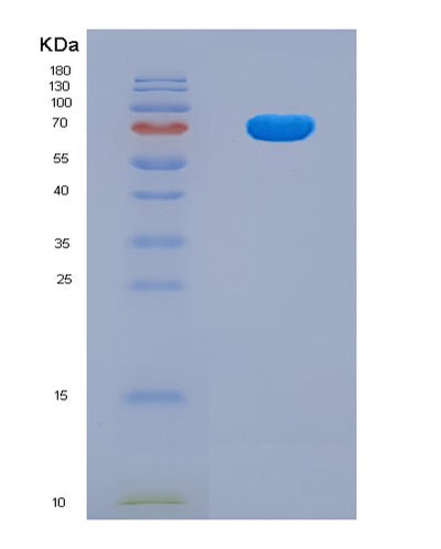 SDS-PAGE analysis of Human CDR2 (Cerebellar Degeneration-Related Protein 2) - Recombinant Protein, CAT# BLT-08065P, showing >90% purity under 15% SDS-PAGE (Reduced)Human CDR2 (Cerebellar Degeneration-Related Protein 2) - Recombinant Protein