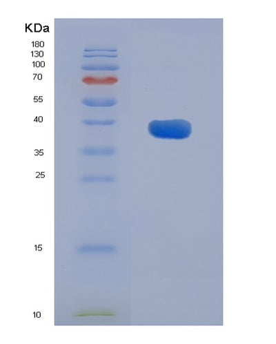 SDS-PAGE analysis of Mouse Aadat (Kynurenine/Alpha-Aminoadipate Aminotransferase, Mitochondrial) - Recombinant Protein, CAT# BLT-08068P, showing >90% purity under 15% SDS-PAGE (Reduced)Mouse Aadat (Kynurenine/Alpha-Aminoadipate Aminotransferase, Mitochondrial) - Recombinant Protein