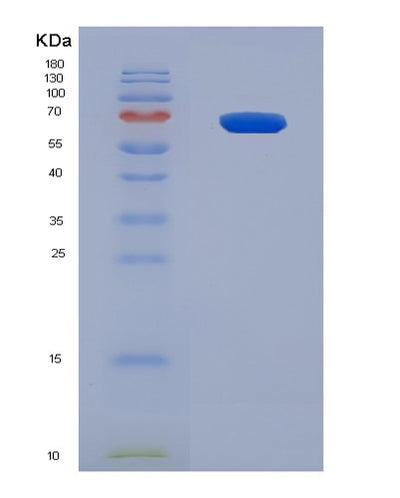 SDS-PAGE analysis of Human NEFL (Neurofilament Light Polypeptide) - Recombinant Protein, CAT# BLT-08069P, showing >90% purity under 15% SDS-PAGE (Reduced)Human NEFL (Neurofilament Light Polypeptide) - Recombinant Protein