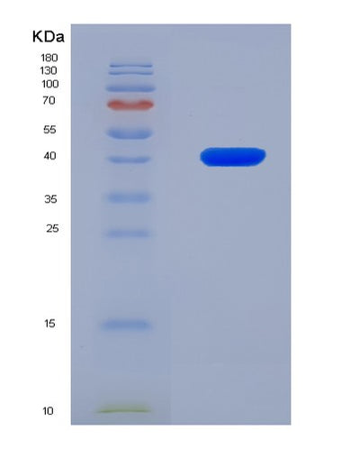 SDS-PAGE analysis of Human SCD (Stearoyl-Coa Desaturase) - Recombinant Protein, CAT# BLT-08070P, showing >90% purity under 15% SDS-PAGE (Reduced)Human SCD (Stearoyl-Coa Desaturase) - Recombinant Protein