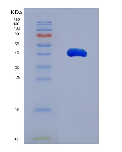 SDS-PAGE analysis of Human ST3GAL6 (Type 2 Lactosamine Alpha-2,3-Sialyltransferase) - Recombinant Protein, CAT# BLT-08072P, showing >90% purity under 15% SDS-PAGE (Reduced)Human ST3GAL6 (Type 2 Lactosamine Alpha-2,3-Sialyltransferase) - Recombinant Protein