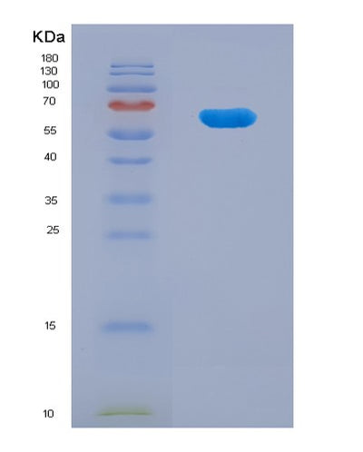 SDS-PAGE analysis of Human MGAT4A (Alpha-1,3-Mannosyl-Glycoprotein 4-Beta-N-Acetylglucosaminyltransferase A) - Recombinant Protein, CAT# BLT-08073P, showing >90% purity under 15% SDS-PAGE (Reduced)Human MGAT4A (Alpha-1,3-Mannosyl-Glycoprotein 4-Beta-N-Acetylglucosaminyltransferase A) - Recombinant Protein
