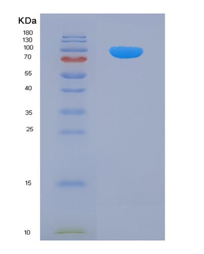 SDS-PAGE analysis of Human AP2B1 (Ap-2 Complex Subunit Beta) - Recombinant Protein, CAT# BLT-08074P, showing >90% purity under 15% SDS-PAGE (Reduced)Human AP2B1 (Ap-2 Complex Subunit Beta) - Recombinant Protein