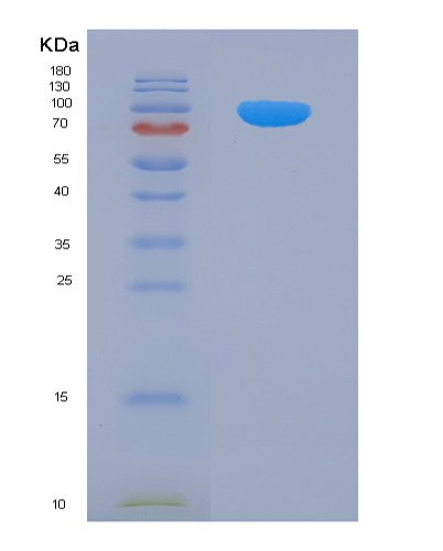 SDS-PAGE analysis of Human AP2B1 (Ap-2 Complex Subunit Beta) - Recombinant Protein, CATHuman AP2B1 (Ap-2 Complex Subunit Beta) - Recombinant Protein